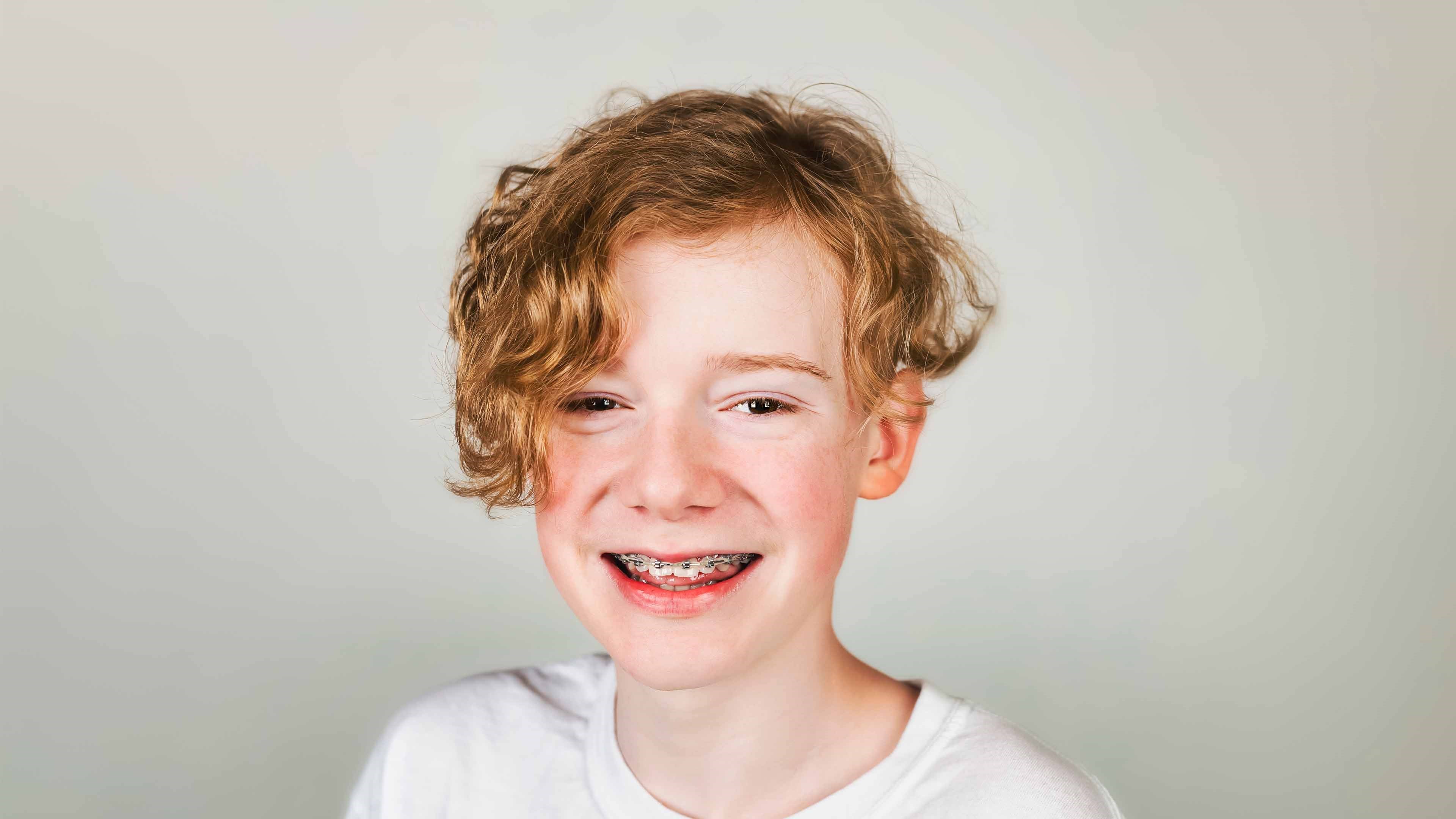 Retainers