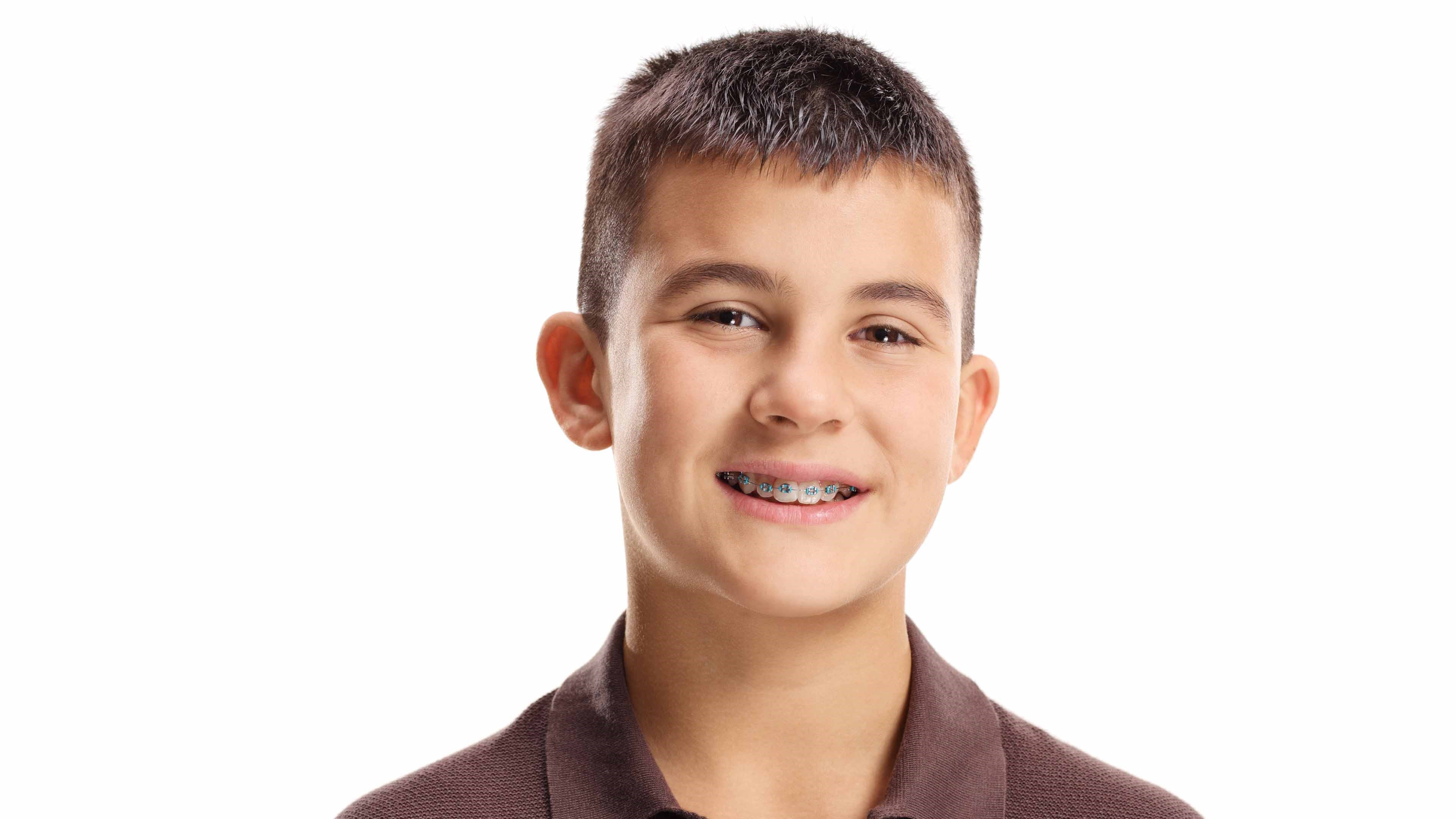Braces
